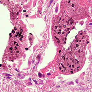 Case282_B.jpg