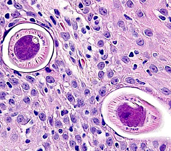 Case283_B.jpg