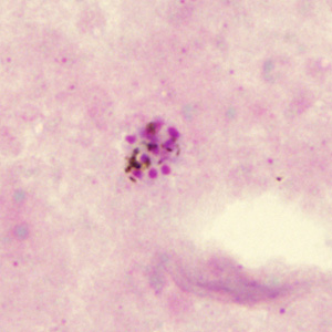 Case285_B.jpg