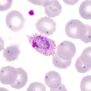 Case285_C.jpg