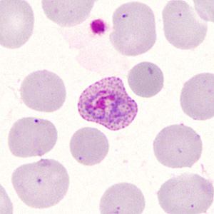 Case285_E.jpg