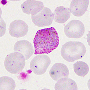 Case285_F.jpg
