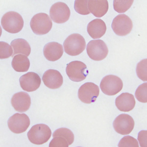 Case287_B.jpg
