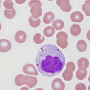 Case287_C.jpg