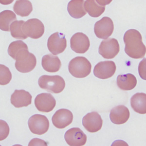 Case287_D.jpg