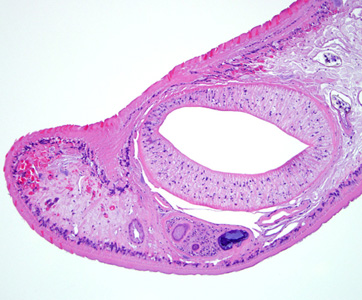 Case288_B.jpg