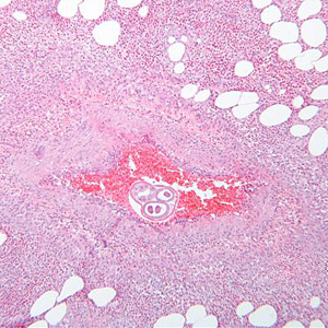 Case289_A.jpg