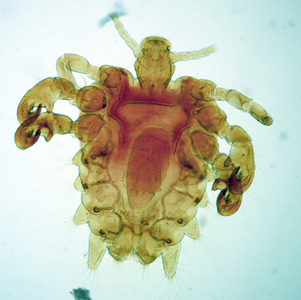 Case292_B.jpg