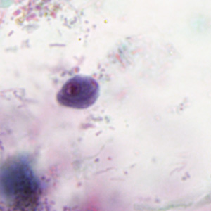 Case293_B.jpg