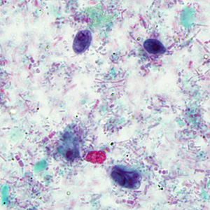 Case293_D.jpg