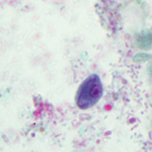 Case293_E.jpg