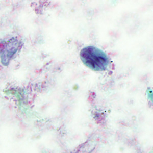 Case293_F.jpg