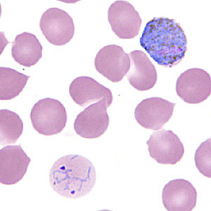 Case295_D.jpg