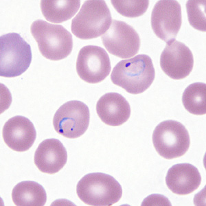 Case295_E.jpg