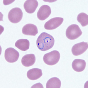 Case295_F.jpg