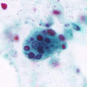 Case296_A.jpg