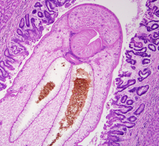 Case299_A.jpg