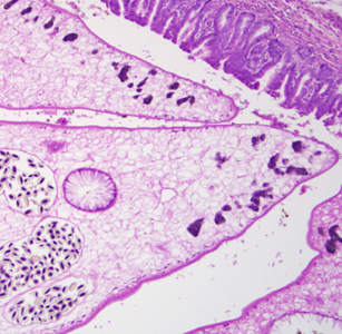 Case299_B.jpg