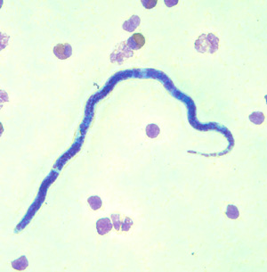 Case301_D.jpg