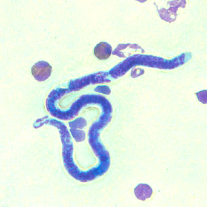 Case301_E.jpg