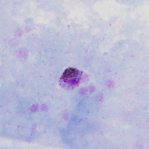 Case302_C.jpg