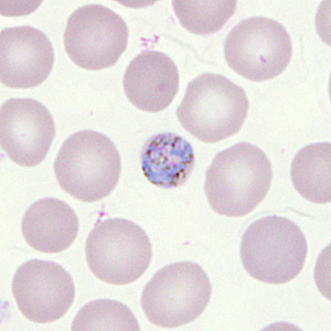 Case302_E.jpg