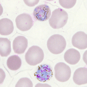 Case302_I.jpg