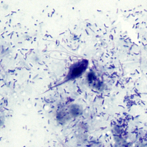 Case303_B.jpg