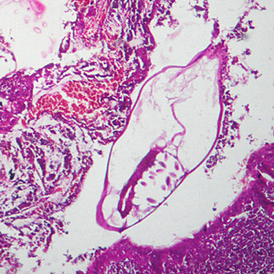 Case305_B.jpg