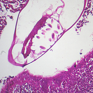 Case305_C.jpg