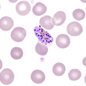 Case306_I.jpg