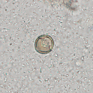 Case309_B.jpg