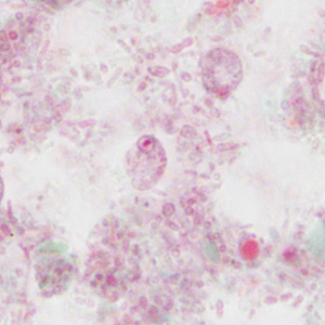 Case310_B.jpg