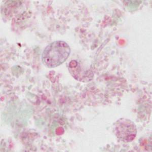 Case310_C.jpg