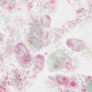 Case310_D.jpg