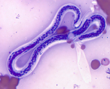 Case311_C.jpg
