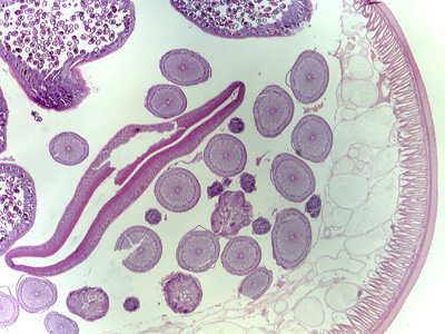 Case315_C.jpg