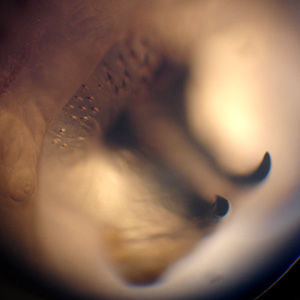 Case316_C.jpg