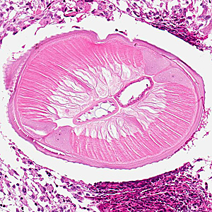 Case317_D.jpg