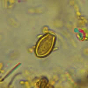 Case318_D.jpg