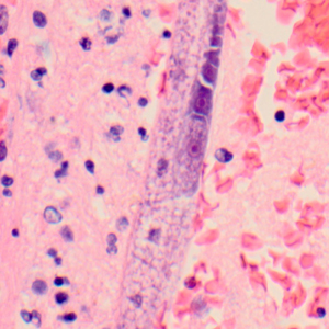 Case319_D.jpg