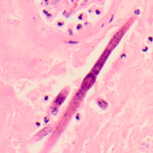 Case319_E.jpg