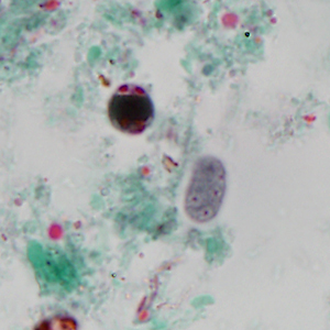 Case320_A.jpg
