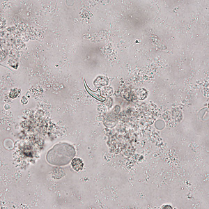Case321_A.jpg