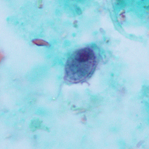 Case322_B.jpg