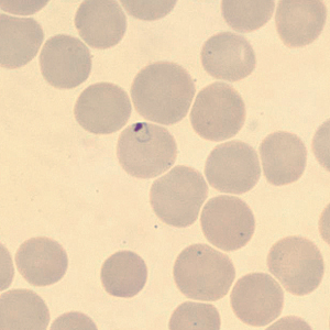May - 2012 - Case #323