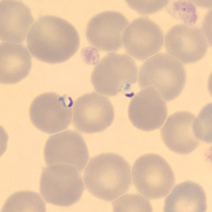 Case323_C.jpg