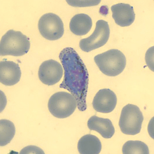 Case323_H.jpg