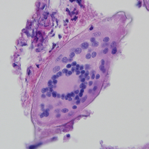 Case324_B.jpg