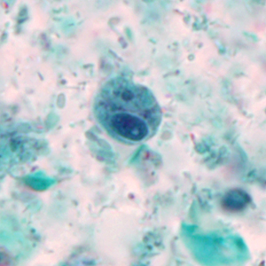 Case327_B.jpg